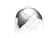 More effective diagnosis